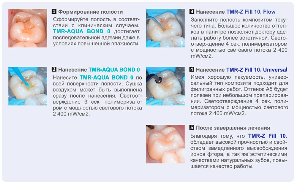 Ямакинтамзефилл7